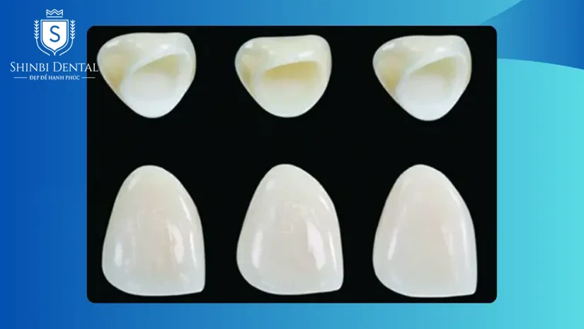 Răng sứ Venus là gì? Có tốt không và có mấy loại?