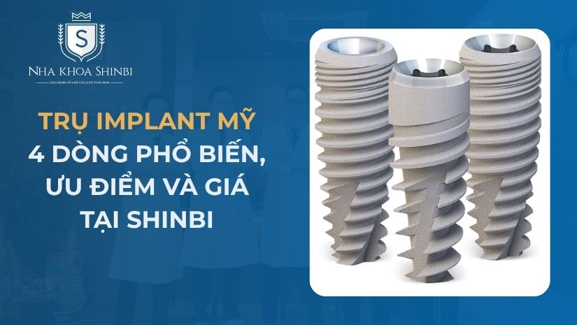 Trụ Implant Mỹ: 4 Dòng Phổ Biến, Ưu Điểm Và Giá Tại Shinbi