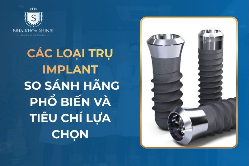Các Loại Trụ Implant: So Sánh Hãng Phổ Biến và Tiêu Chí Lựa Chọn