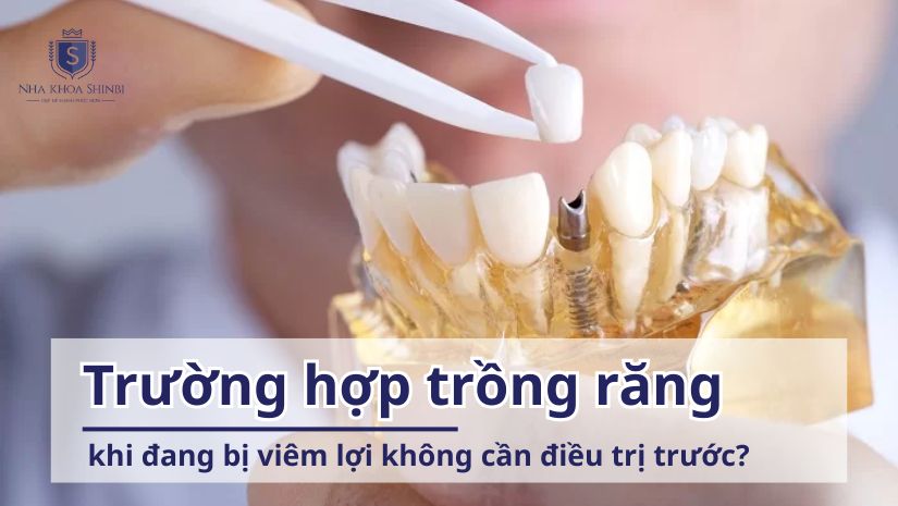 Trường hợp trồng răng khi đang bị viêm lợi không cần điều trị trước?