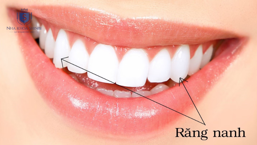 Tư vấn làm răng nanh sứ dài đẹp để có hàm răng mong muốn